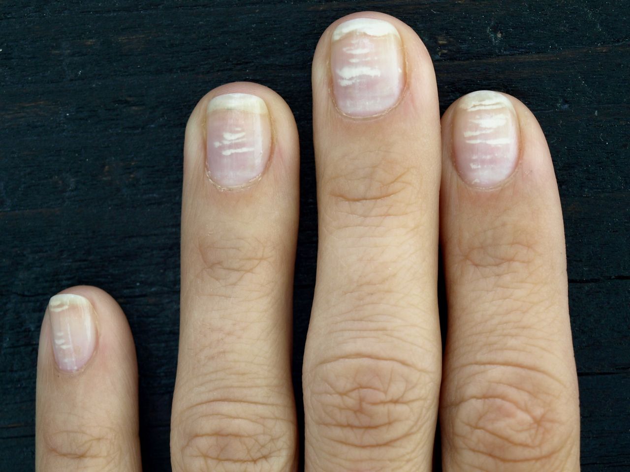 Nails indicate our health condition