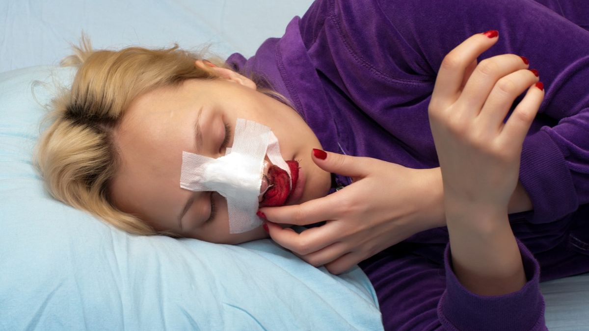 Dla osób z hipofibrynogenemią, rzadkim zaburzeniem krwi, krwotoki z nosa mogą być one niezwykle niezbezpieczne.