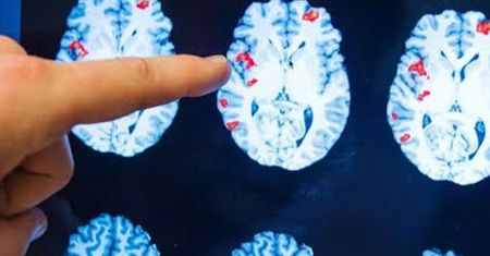 Ile szczegółów! Przeżyła śmierć kliniczną. Mówi, co widziała po drugiej stronie