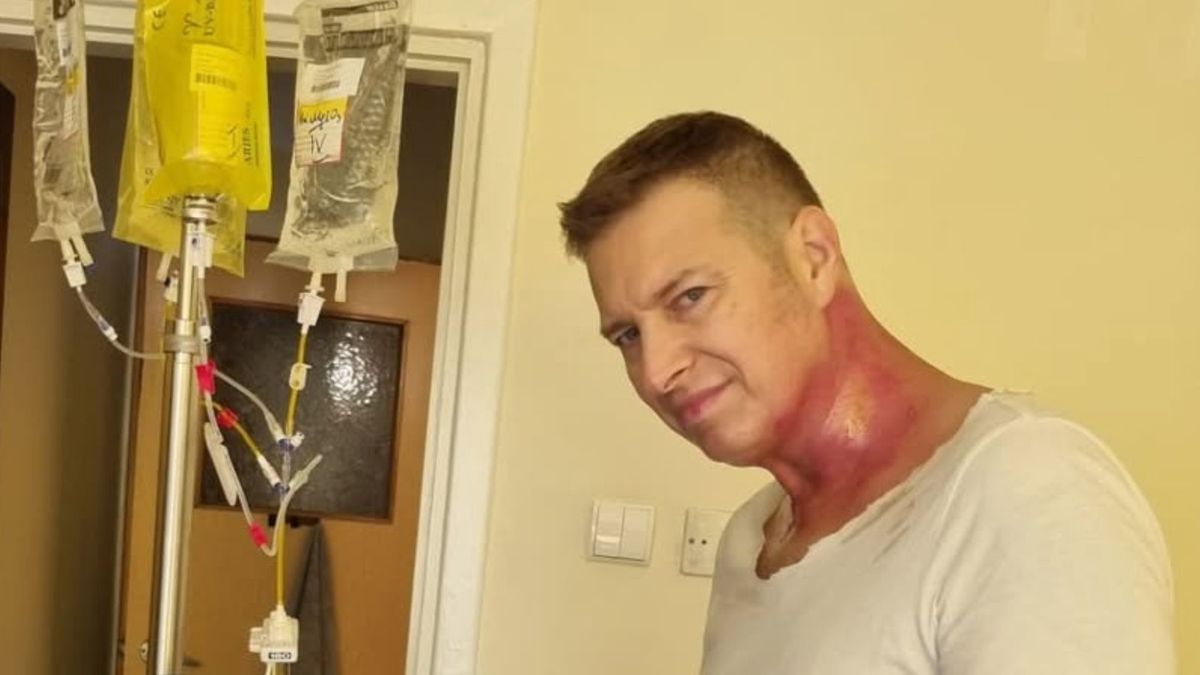 Maciej Jachowski o chorobie nowotworowej