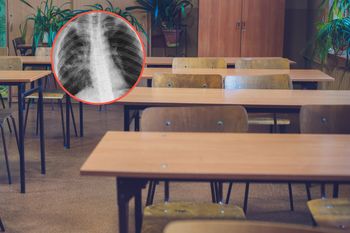 Gruźlica w krakowskim liceum. Uczeń trafił do szpitala, trwa dochodzenie