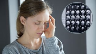 Nowa nadzieja dla chorych. To pierwszy taki lek na glejaka