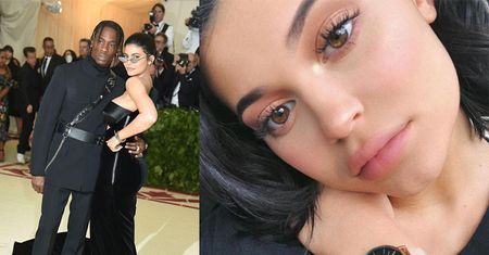 Kylie usunęła wypełniacze pod wpływem chłopaka! "Travis zachęca ją do bycia bardziej naturalną"