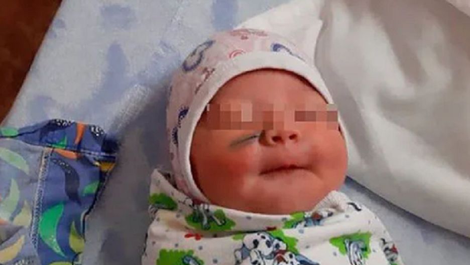 Lekarze przecięli twarz dziecka podczas porodu