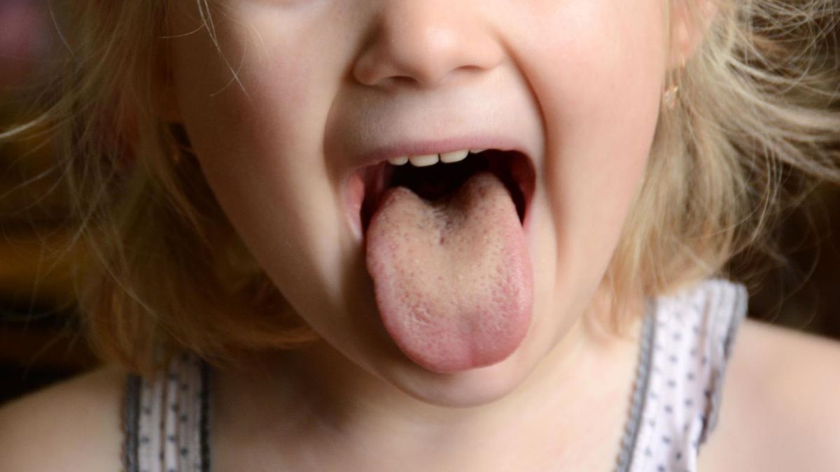 W celu wyleczenia anginy konieczne jest podjęcie terapii antybiotykowej