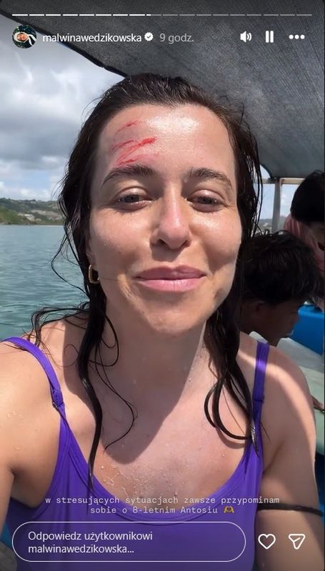Malwina Wędzikowska miała wypadek na wakacjach 