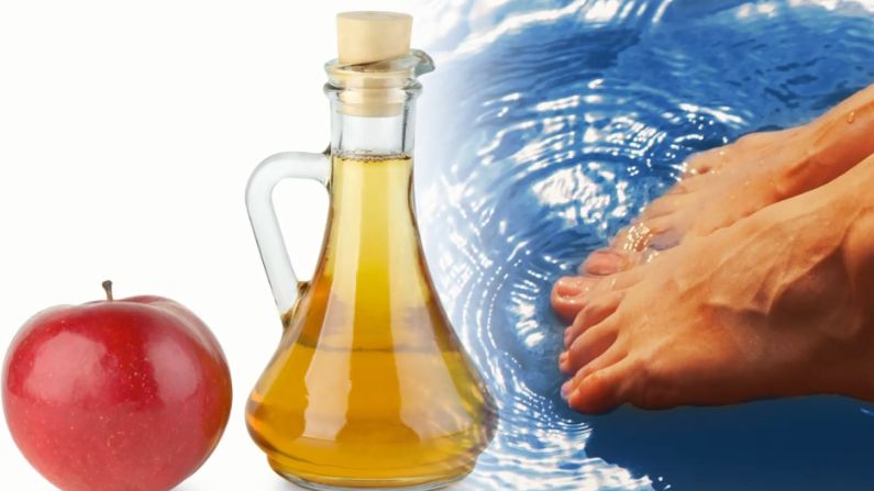 Moczenie stóp w wodzie z octem pomoże w naturalny sposób o nie zadbać