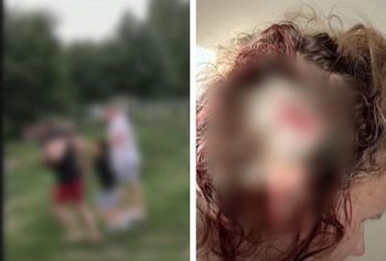 Policjant z Płocka podejrzany o przemoc wobec rodziny. Miał zaatakować byłą żonę i synów pałką teleskopową i gazem pieprzowym!