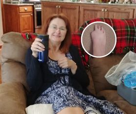 Straciła palca u stopy przez pedicure. Ma ważną radę