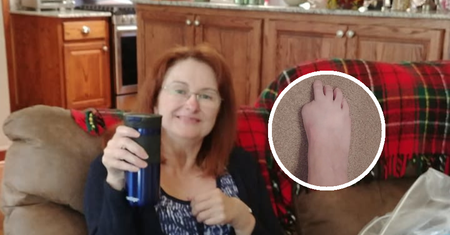Straciła palca u stopy przez pedicure. Ma ważną radę