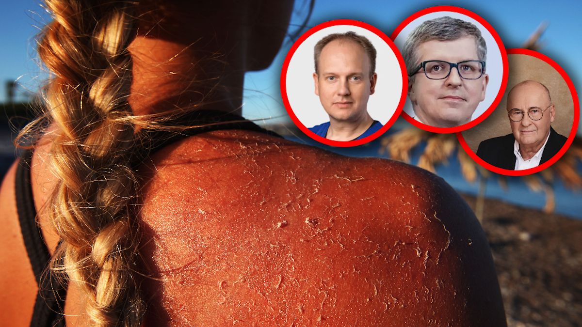Ceną za piękną opaleniznę czasem bywa nowotwór