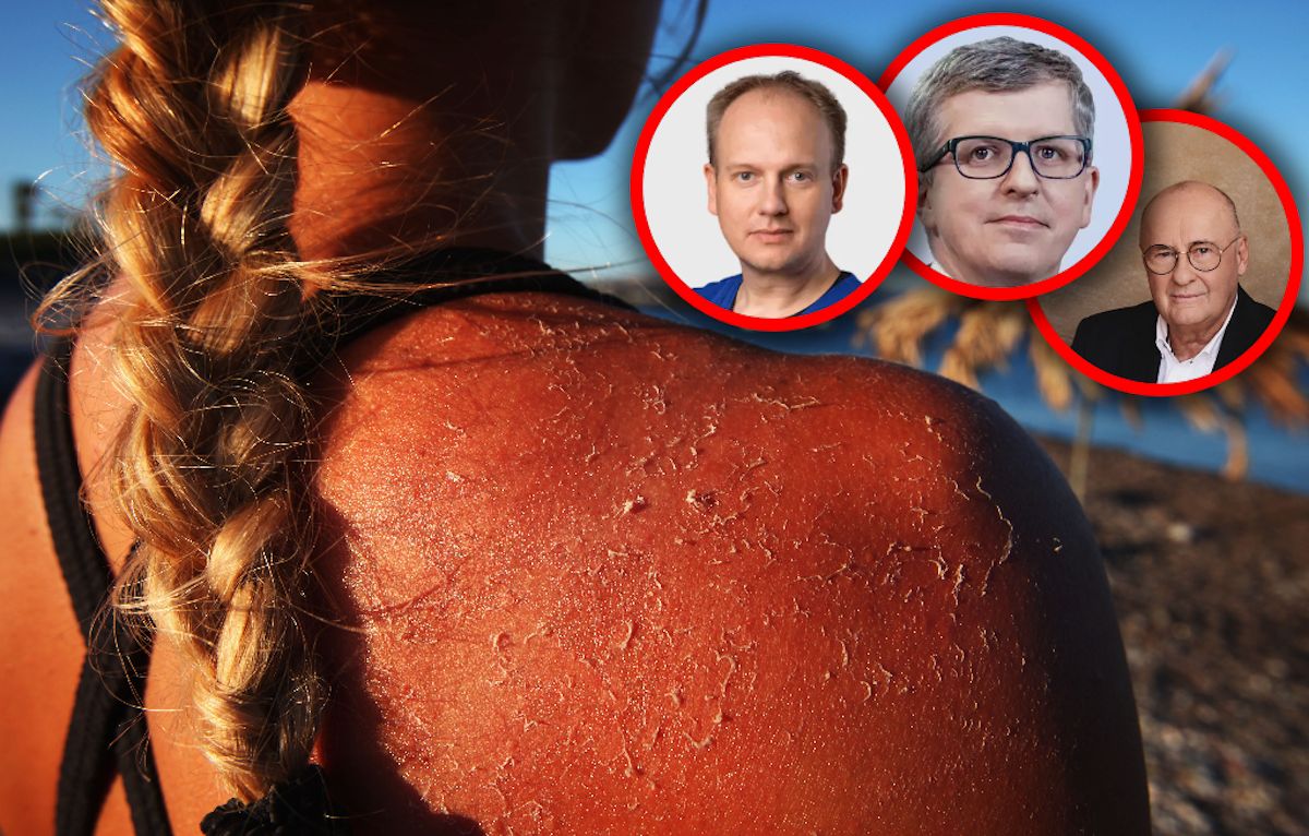 Tak Polacy generują raka w wakacje. "Nagła i intensywna ekspozycja"