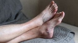 Tak cukrzyca wyniszcza organizm. Nie lekceważ charakterystycznych objawów