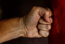 Śląskie. Dramat w Żorach. Nieskuteczny zakaz zbliżania. Mężczyzna brutalnie pobił partnerkę