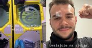 Albert Kosiński uległ WYPADKOWI. Wrzucił zdjęcie z karteki