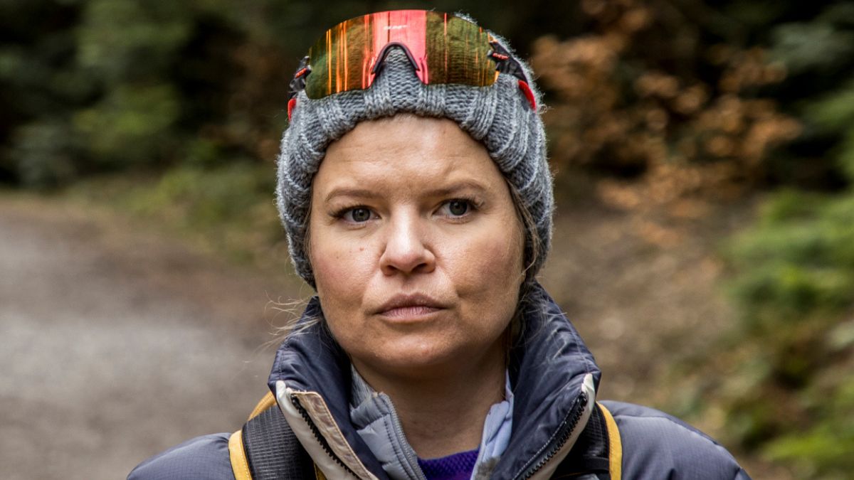 Marta Manowska pokazała twarz dzień po zabiegu kosmetycznym