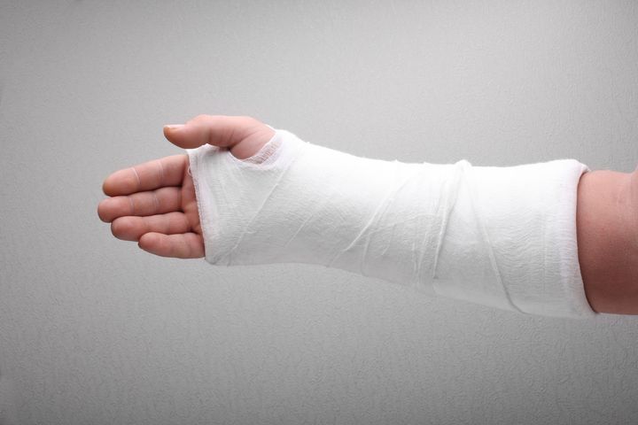 Niezależnie od rodzaju złamania czy zwichnięcia, w przypadku urazu konieczna jest interwencja lekarza ortopedy.