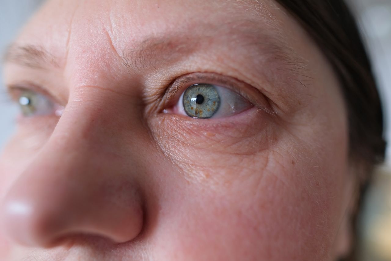 close up and front view on the blue eye of a mature caucasian woman in her forties, showing heavy wrinkles (crow's feet) in the corner and below the eye, with copy-space
eyes, face, woman, age, botox, female, skin, facial massage, decorative, increase, acid, pump up, cosmetics, rejuvenation, injection, texture, natural, cosmetic, fragrance, chubby, anti-aging, procedures, facial, massage, shape, wrinkles, eyelids, gray, lenses, vision, health, treatment, medicine, oculist, testing, examining, eye care, person, forehead, overhang, correction, ophthalmology, caucasian, consultation, checkup, iris, spots