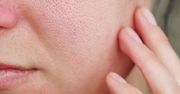 Rozpuść w wodzie i nałóż na twarz. Efekt? Cera jak marzenie