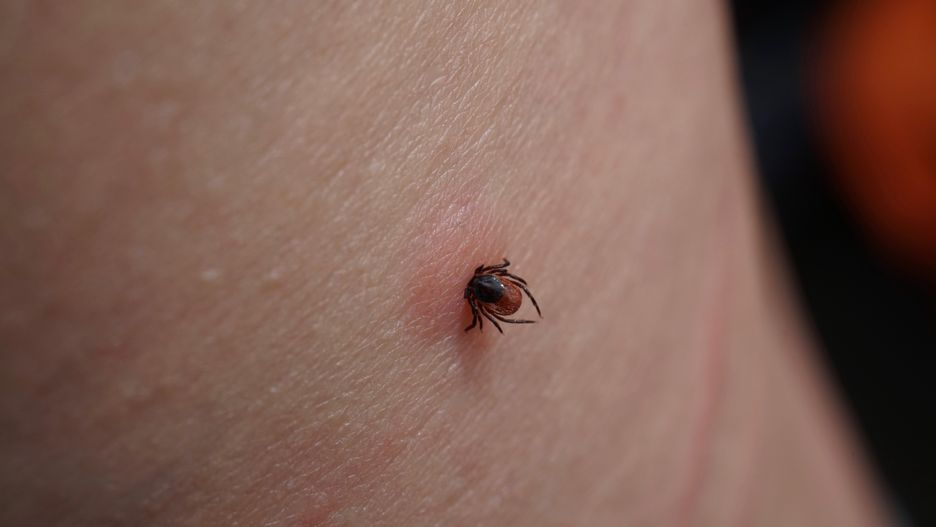 animal, bite, blood, body, borreliosis, bug, carrier, close, close-up, closeup, danger, dangerous, design, detail, disease, disinfection, encephalitis, female, health, human, illness, infection, infectious, insect bite, irritation, ixodes, ixodes ricinus, lyme, macro, medical, meningitis, mouth, outdoor, parasite, parasitic, person, red rash, remove, ricinus, scary, skin, small, sting, suck, sucker, tick, tick bite, tick-borne, vaccination