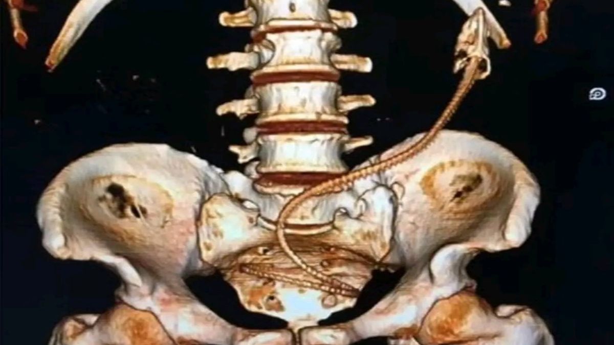 Mężczyzna z węgorzem w odbycie