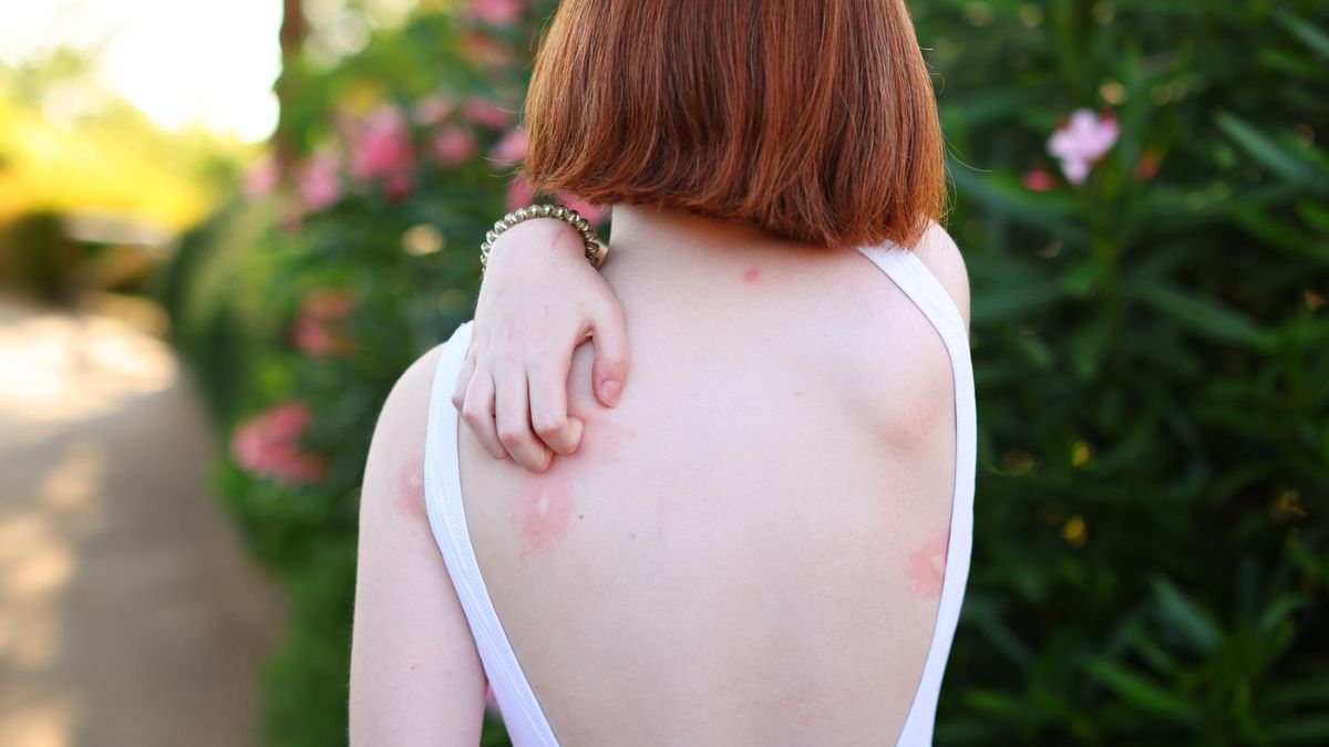 Komary przenoszą tropikalne zagrożenie. Wirus Usutu jest już w Polsce