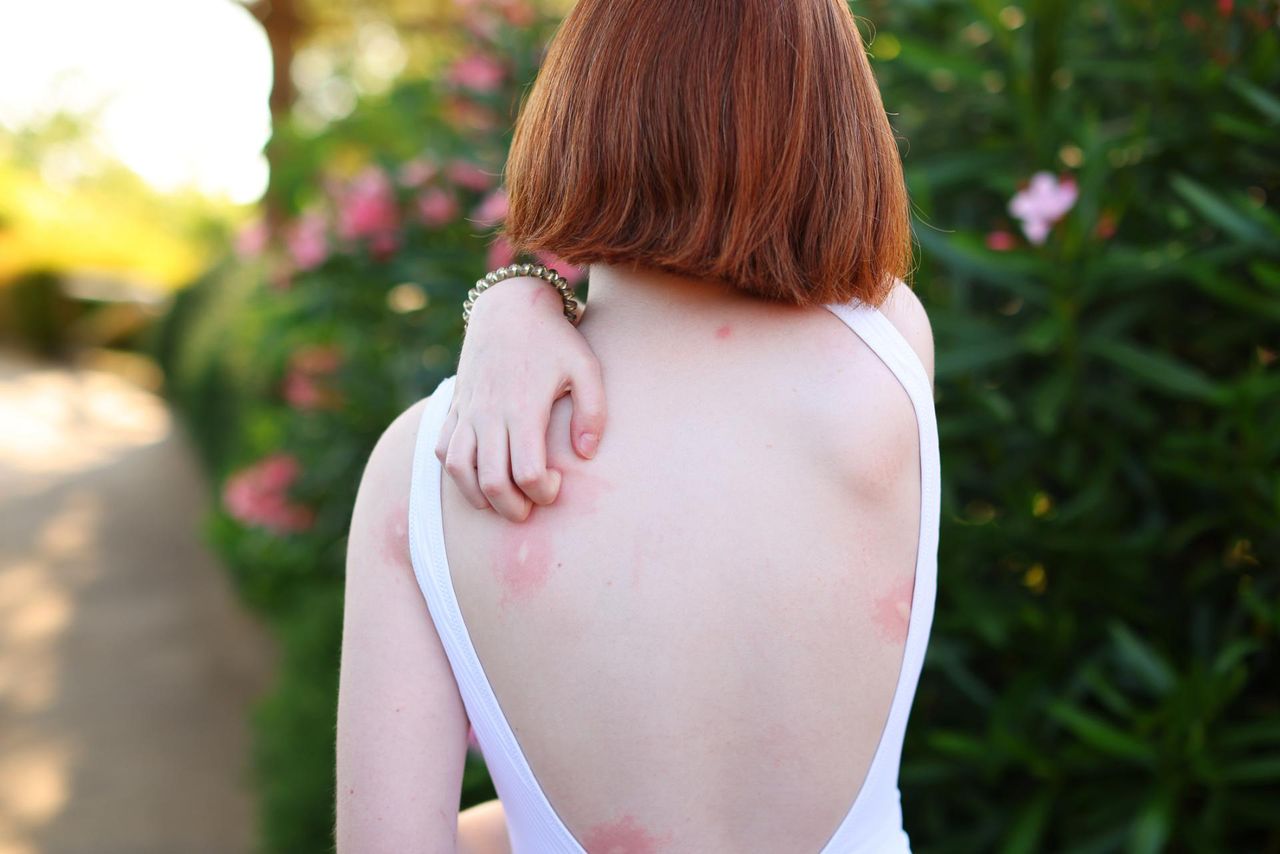 Wirus Usutu czai się w Polsce. Takie daje objawy