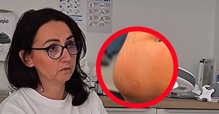 Z wakacji przywiozła "pamiątkę". Lekarka apeluje