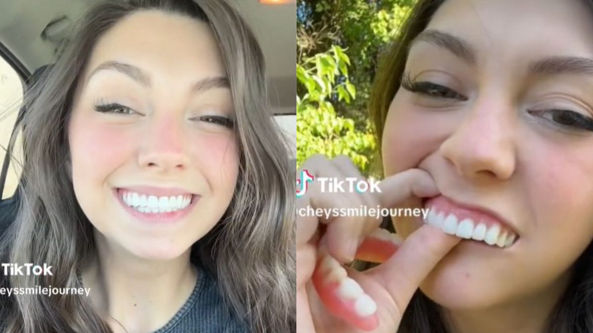 Straciła wszystkie zęby przez aparat ortodontyczny. Od 20 roku życia nosi protezę. 