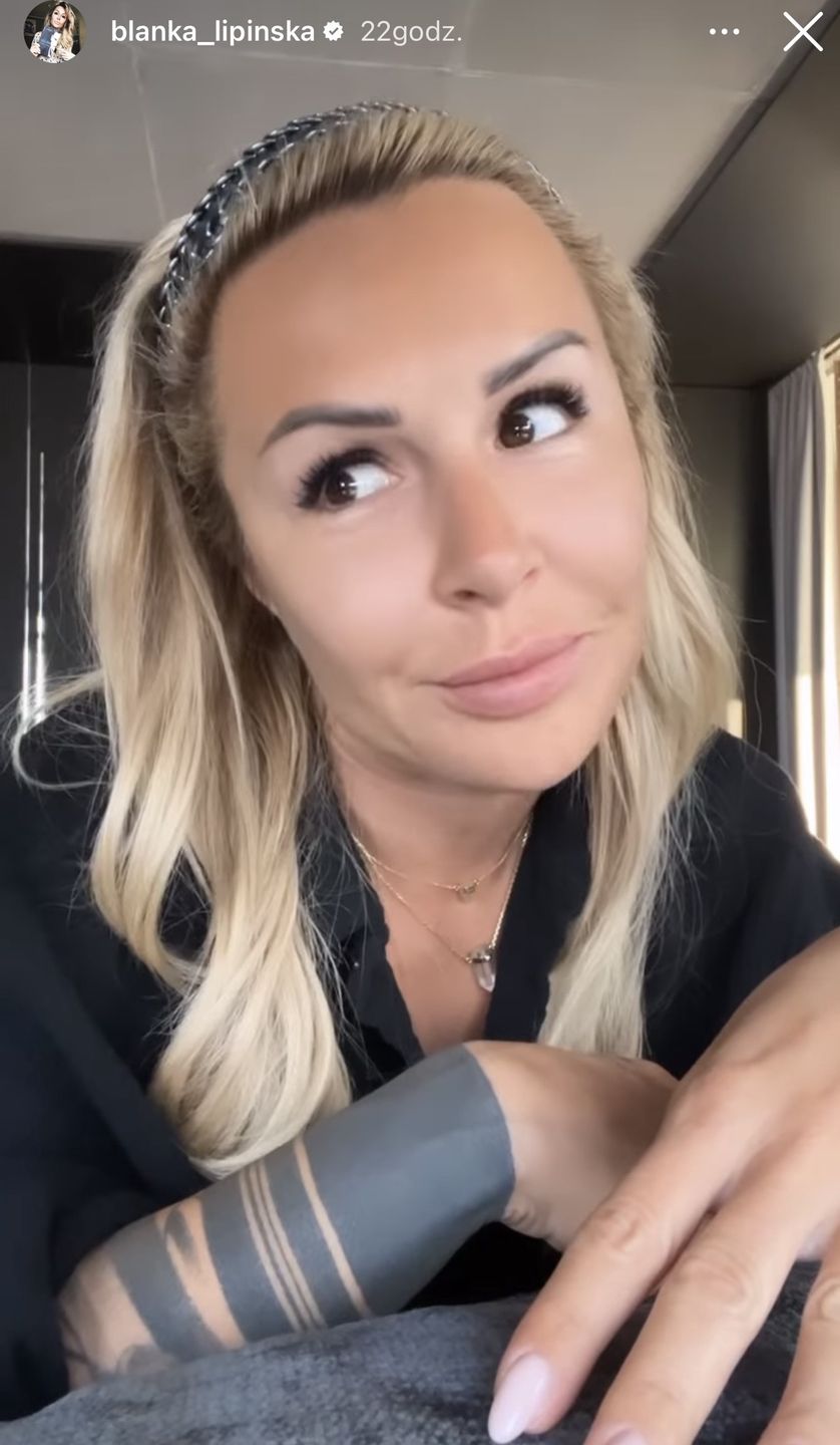Blanka Lipińska cierpliwie wylicza, "CO MA W TWARZY ZROBIONEGO"