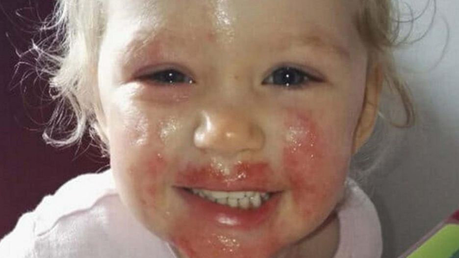 Tajemnicza choroba "zjadała" małą dziewczynkę. Ustalenie przyczyny trwało osiem miesięcy