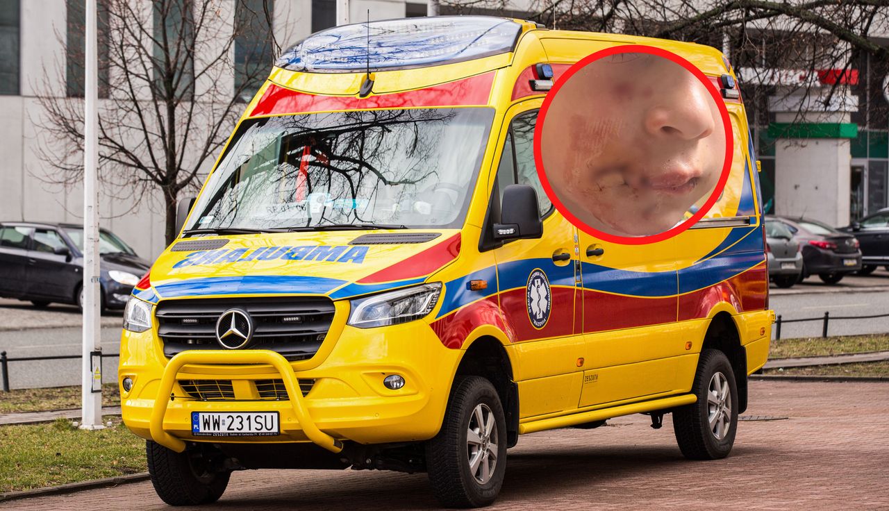 Rzucił się na 6-latka. Koszmarny finał ataku psa pani sołtys