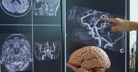 Leukoencefalopatia z zanikającą istotą białą – co to jest, objawy, diagnostyka, leczenie