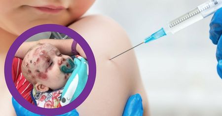 Mama i jej dzieci zakażone. ''Stałam się zagorzałą zwolenniczką szczepień, ponieważ należy myśleć o innych ludziach''