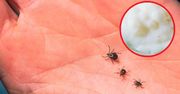 Genialny sposób na kleszcze. Nałóż cienką warstwę na skórę