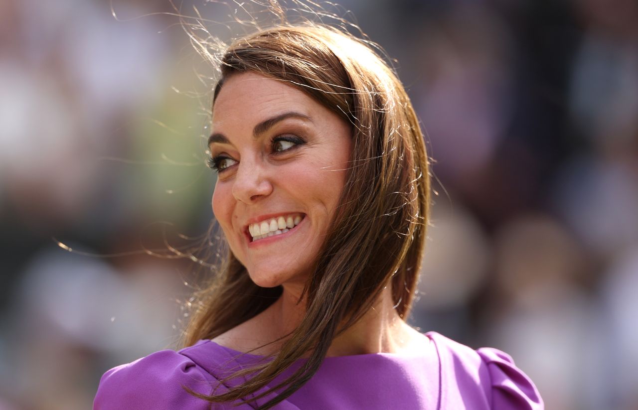 Duchess Kate's resilience: Why she retained her hair during chemo