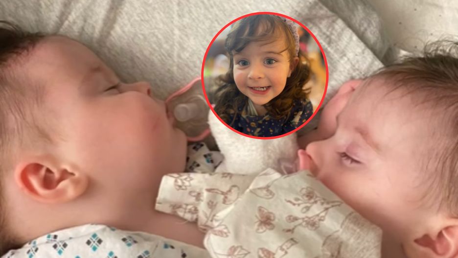 Jak się miewają dzisiaj wyjątkowe bliźniaczki?