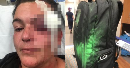 Fotografowie i dziennikarze atakowani przez policję w USA. Są poszkodowani