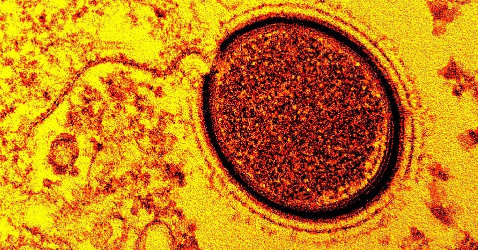 Komórka wirusa Mollivirus sibericum, który leżał w wiecznej zmarzlinie przez 30 tysięcy lat.
