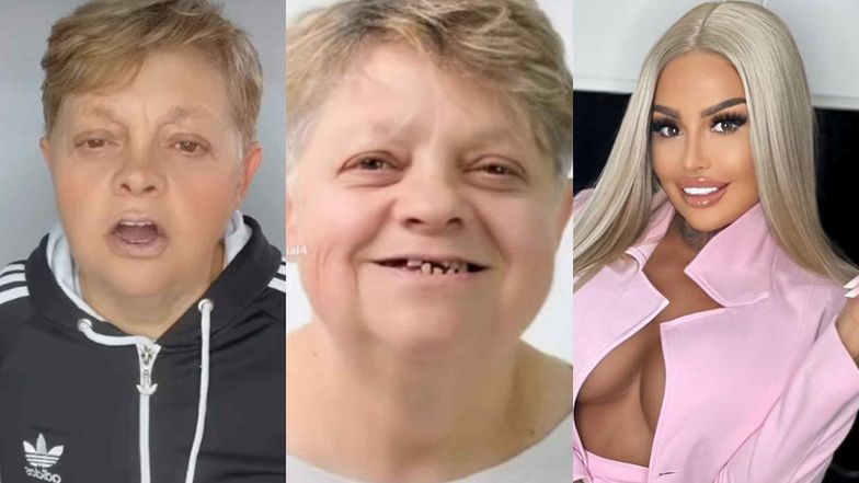 Laluna zafundowała mamie NOWE ZĘBY prosto z Turcji