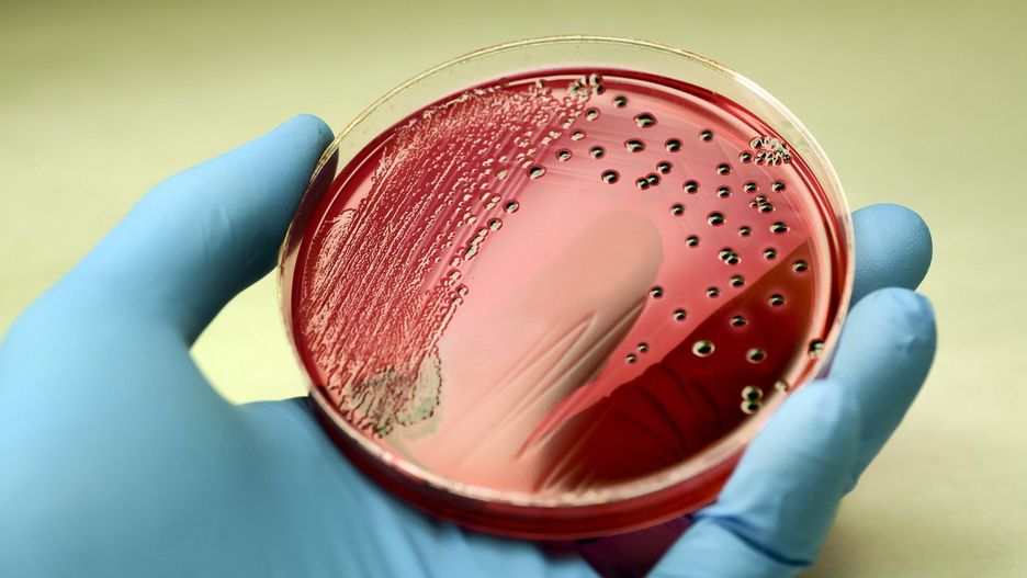 Salmonellą zarazić się można, jedząc żywność skażoną jej bakteriami.