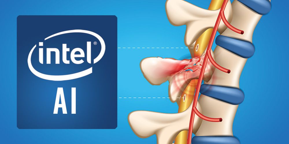 Intel stawia na sztuczną inteligencję, którą chce wykorzystać w medycynie, fot. Intel.