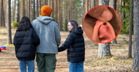 Żaden kleszcz się nie uchowa. Zawsze sprawdzaj te miejsca na ciele