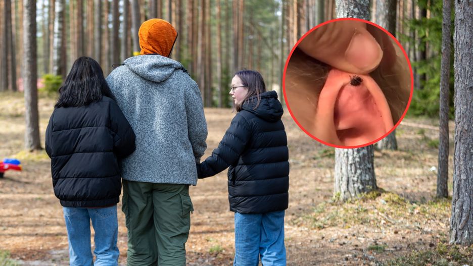 Kleszcz znajdował się w uchu dziecka