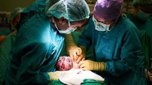 Elective C-sections?