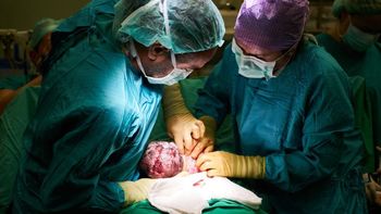 Elective C-sections?