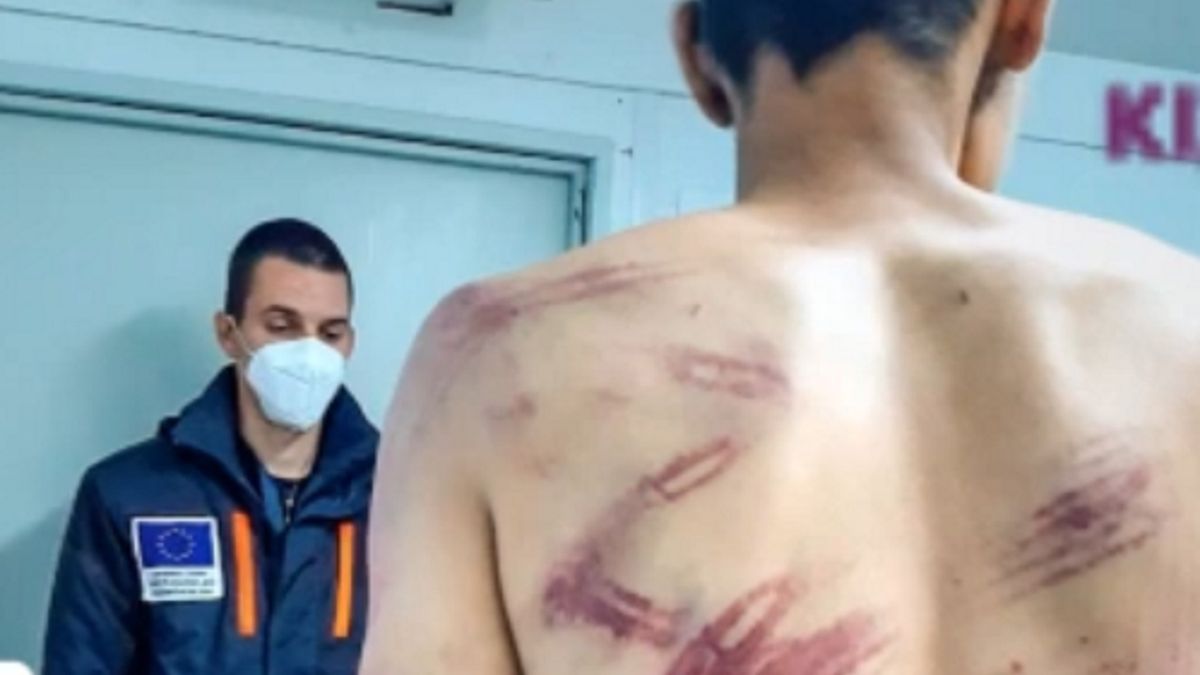 Uchodźcy uciekający przed wojną mieli być torturowani przez policję na chorwackiej granicy. 