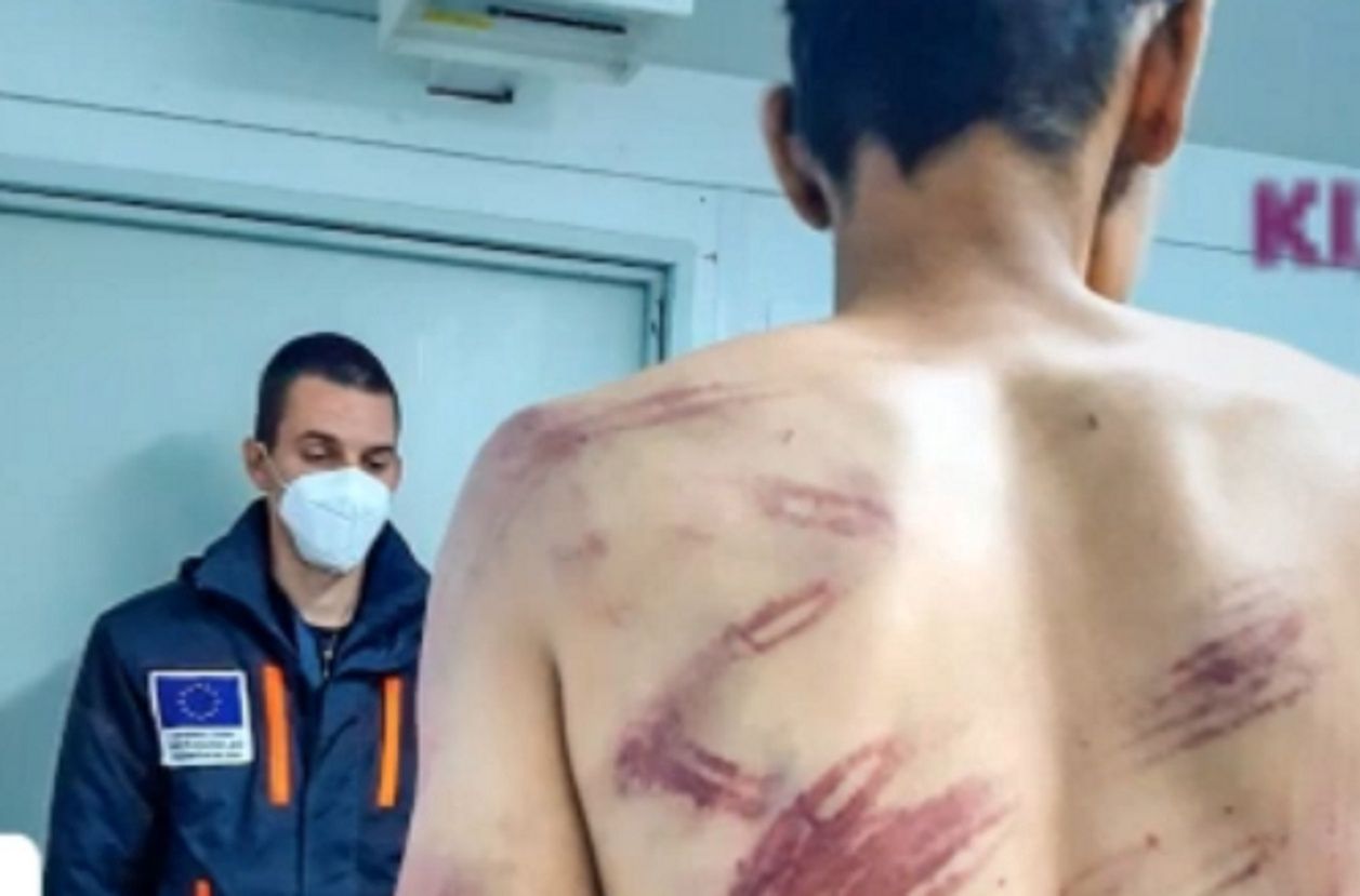 Chorwacka policja ukarała uchodźców. Przerażające