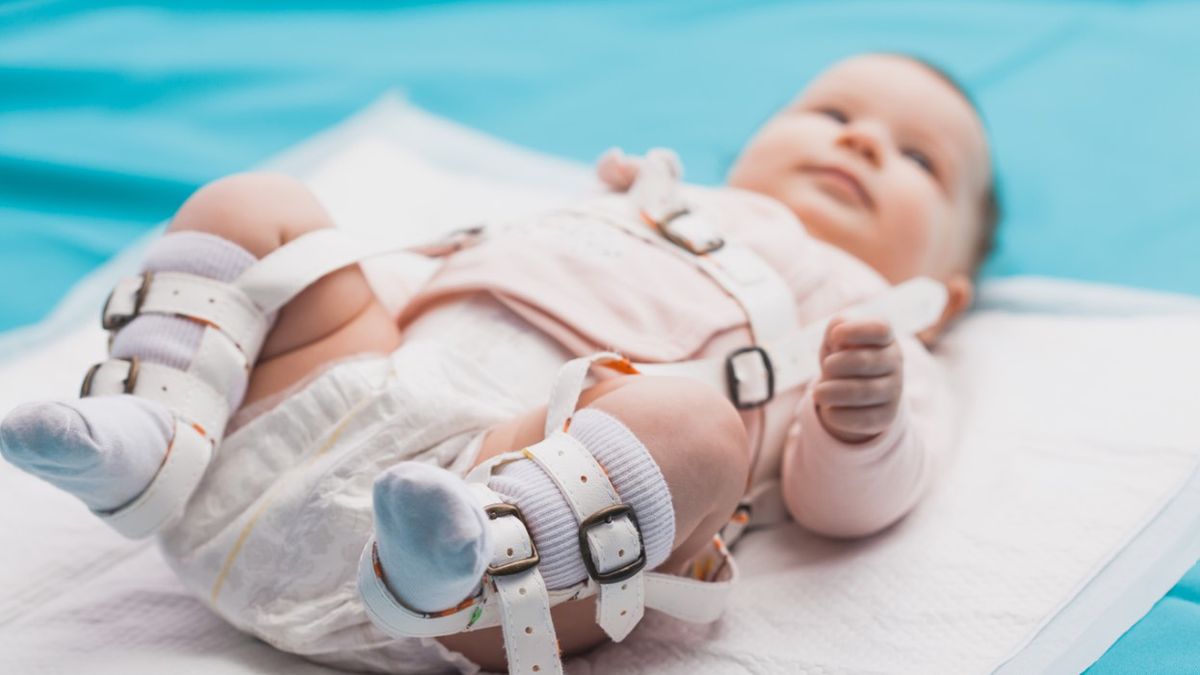 U noworodków najczęściej rozpoznaje się dysplazję stawu biodrowego.