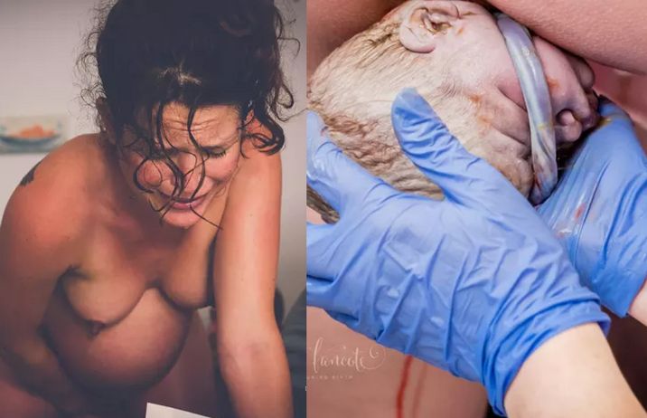 Dziecko okręcone pępowiną